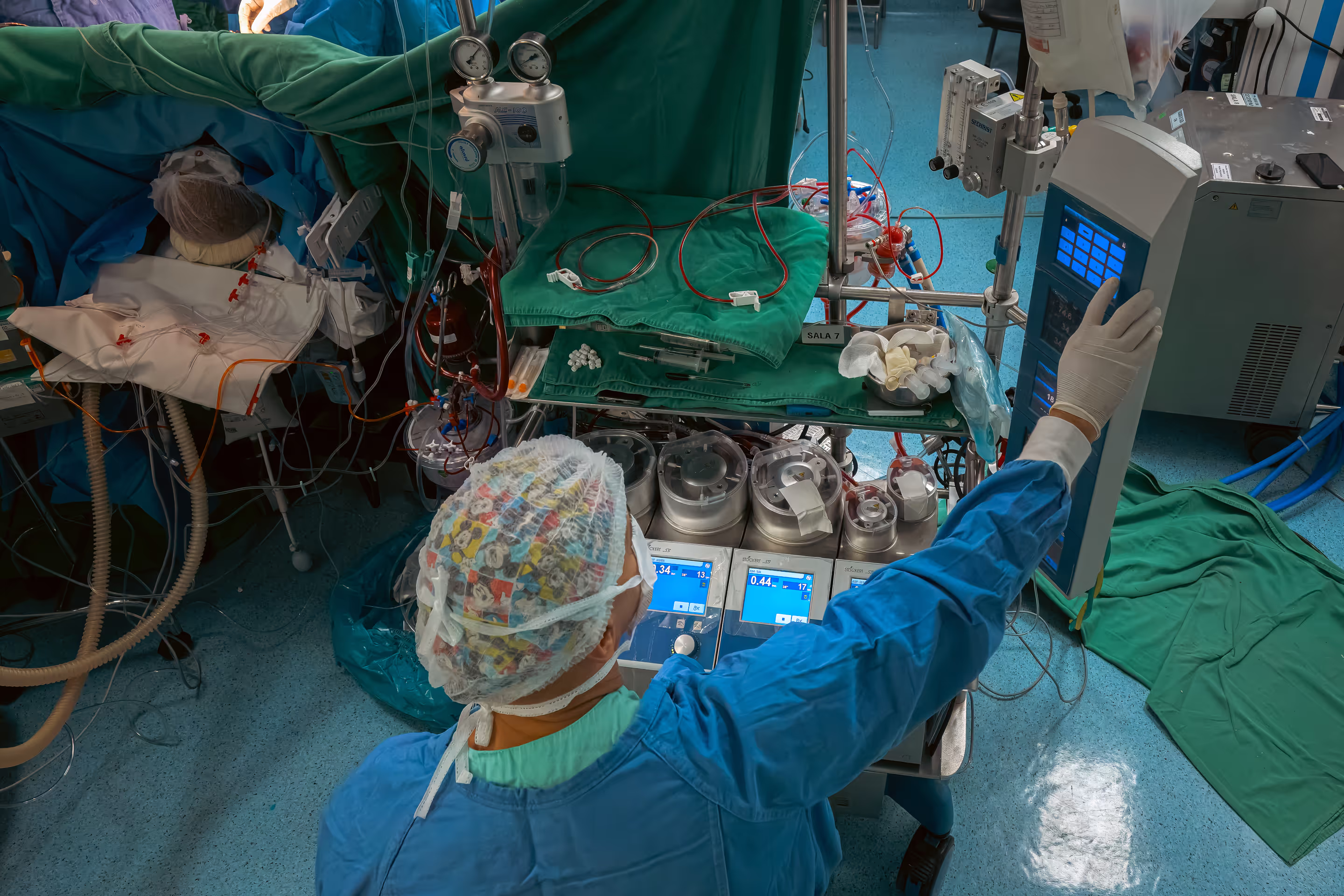 Profissional da saúde visto de costas, usando avental cirúrgico azul, touca estampada e luvas, operando uma máquina de circulação extracorpórea durante uma cirurgia. A imagem mostra diversos equipamentos médicos conectados por tubos e cabos, incluindo bombas peristálticas com telas digitais e dispositivos de monitoramento. À esquerda, parte do paciente está coberta por campos cirúrgicos verdes e azuis, e vários tubos ligados ao corpo indicam um procedimento complexo. O ambiente é uma sala de cirurgia equipada, com piso azul e iluminação intensa.